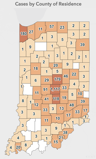 This Indiana Coronavirus Map shows cases by county of residence as of March 31. The site shows other data and is updated daily by the Indiana State Department of Health.